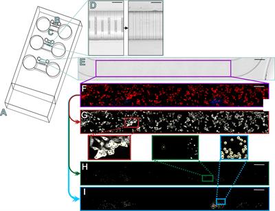 IDO1 Inhibition Reduces Immune Cell Exclusion Through Inducing Cell Migration While PD-1 Blockage Increases IL-6 and -8 Secretion From T Cells in Head and Neck Cancer